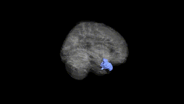 Full Brain Black