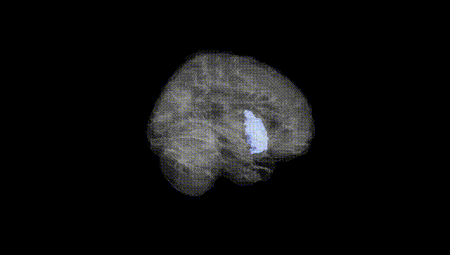 Full Brain Black