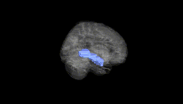 Full Brain Black