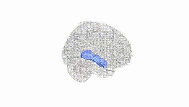 Full Brain White