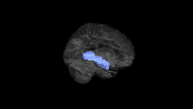 Hemisphere Black