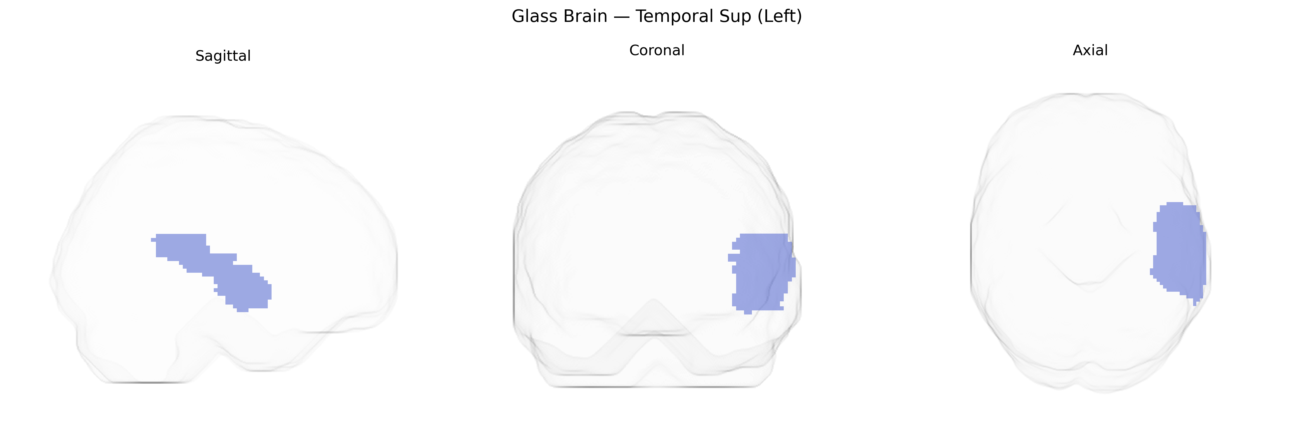 Triplanar Ghost Brain