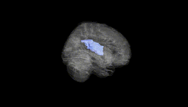 Full Brain Black