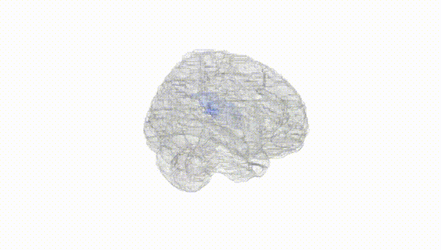 Full Brain White