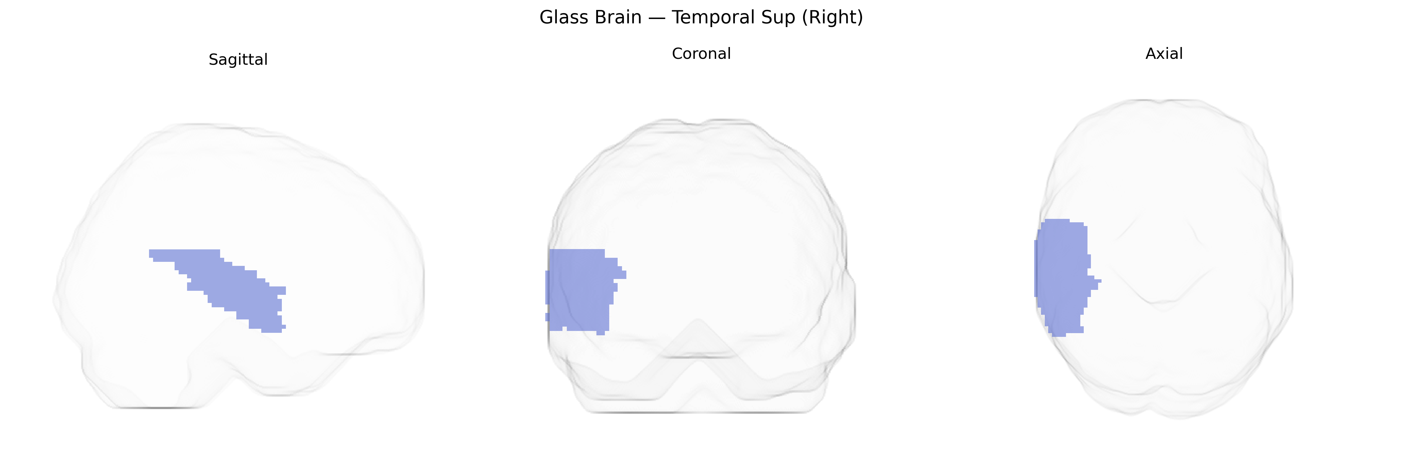 Triplanar Ghost Brain