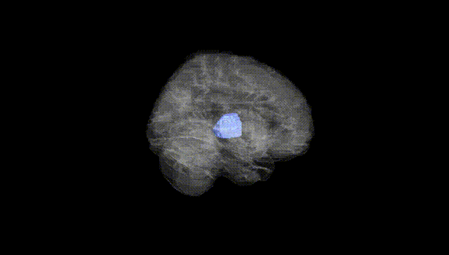 Full Brain Black