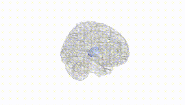 Full Brain White