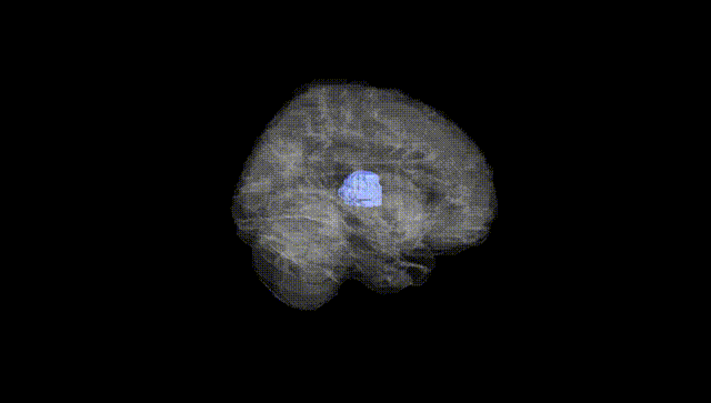 Full Brain Black