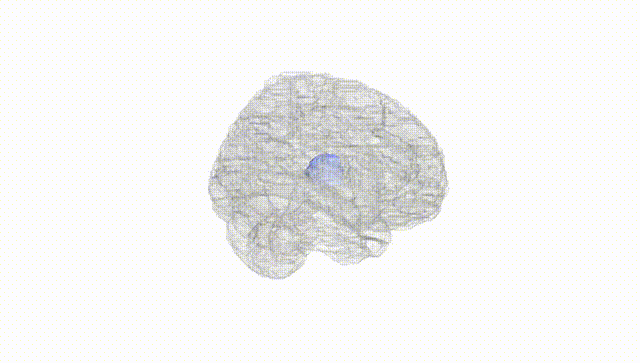 Full Brain White
