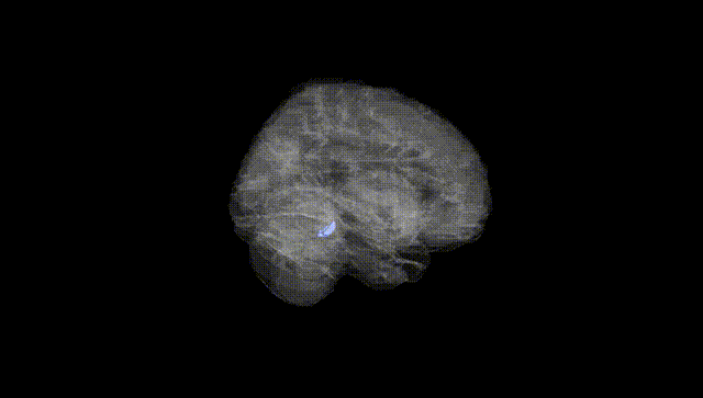 Full Brain Black