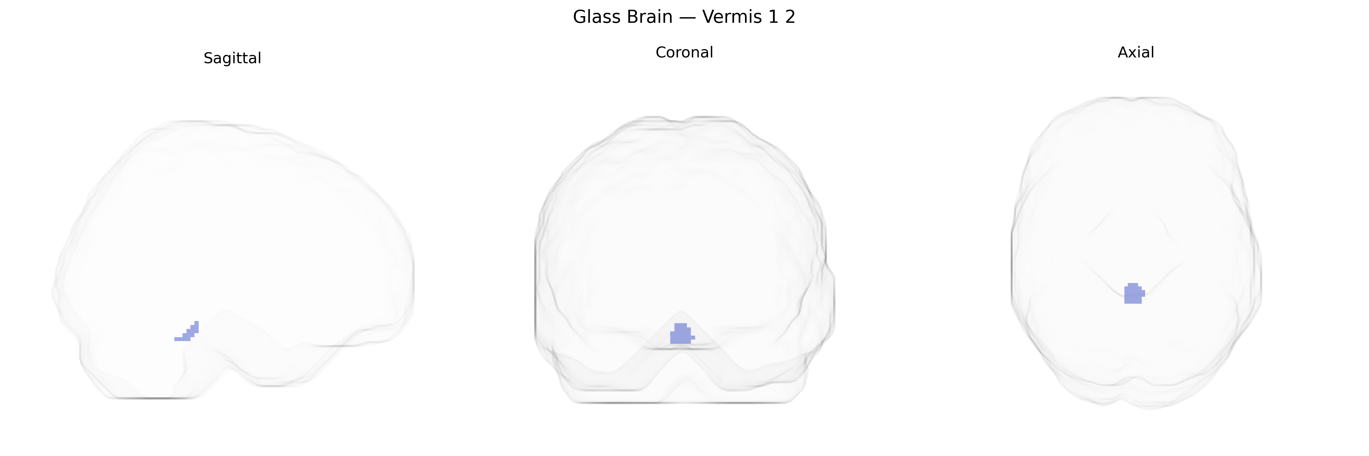 Triplanar Ghost Brain