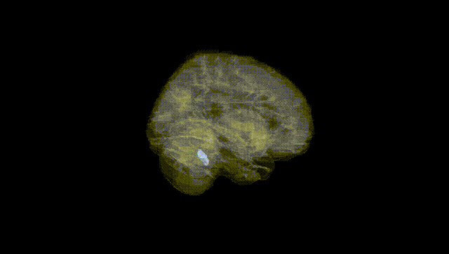 Full Brain Black