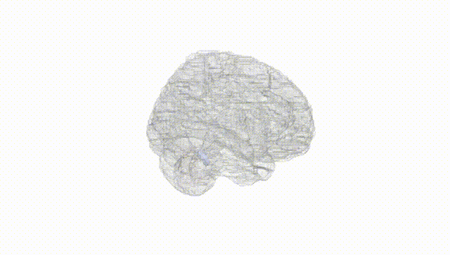 Full Brain White