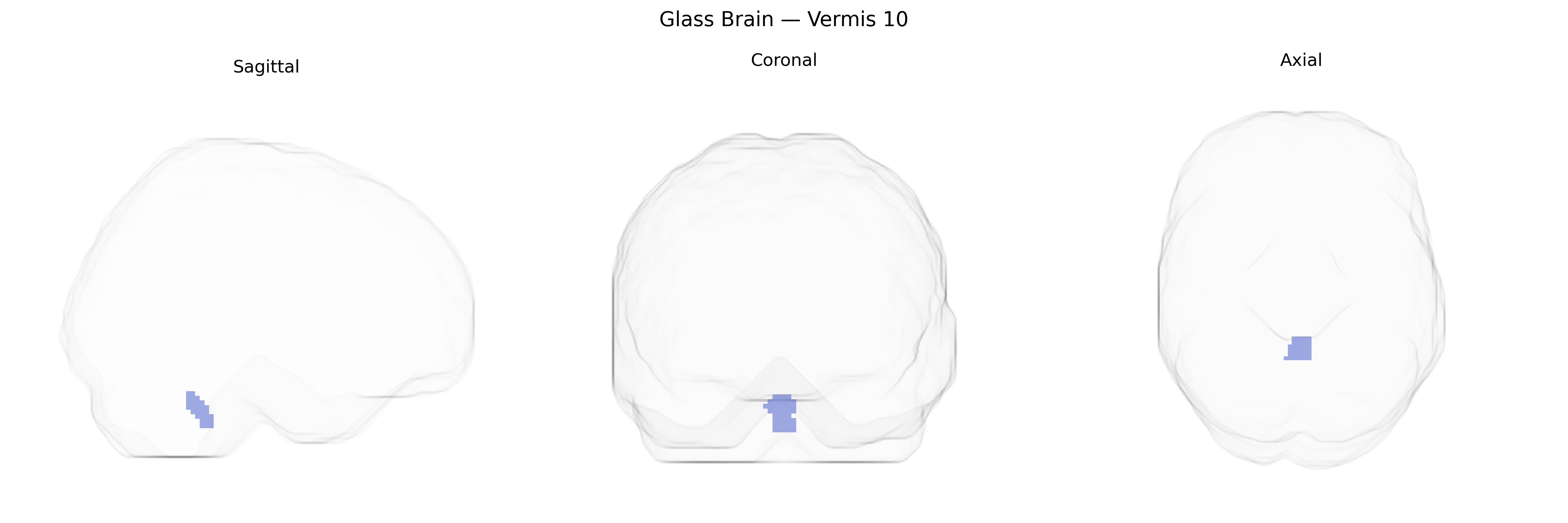 Triplanar Ghost Brain