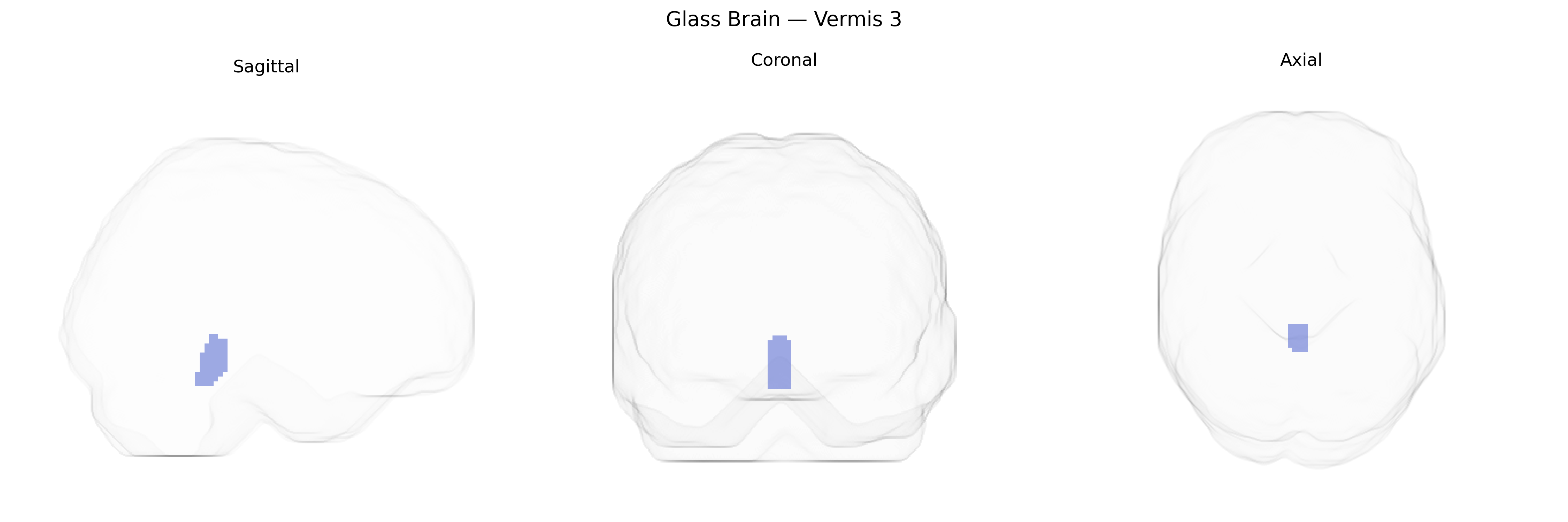 Triplanar Ghost Brain