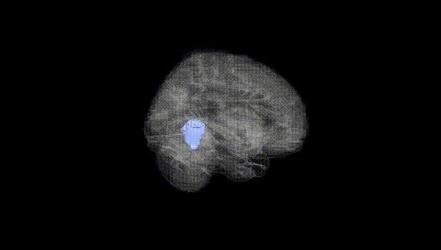 Full Brain Black