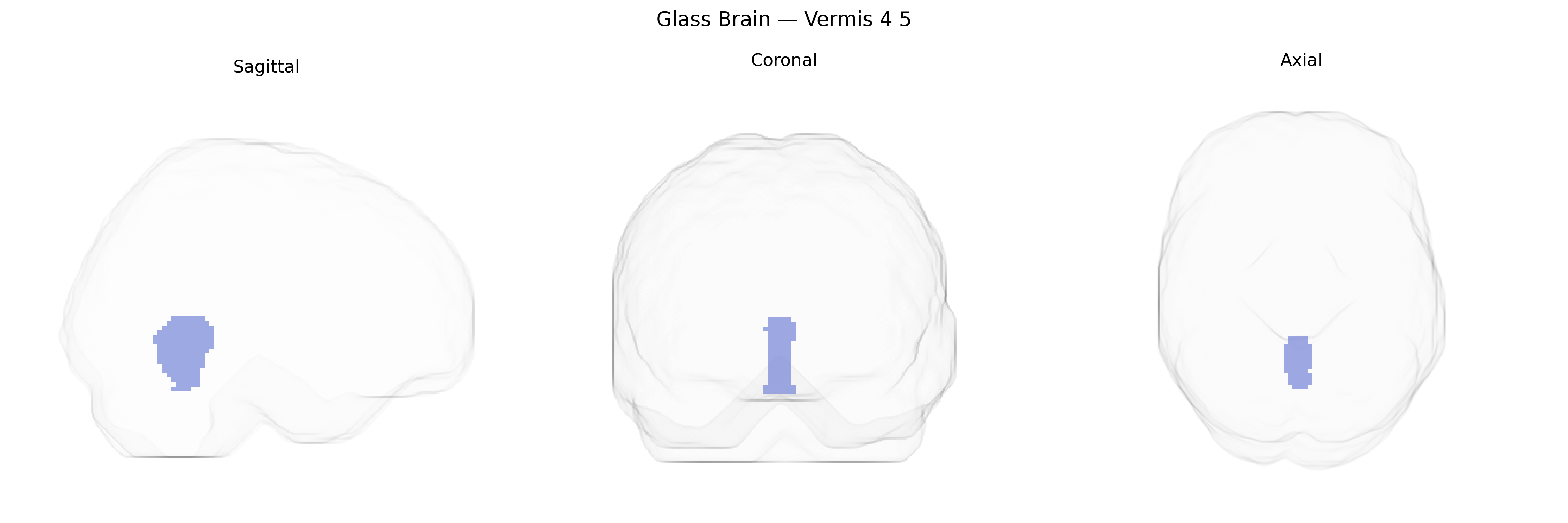 Triplanar Ghost Brain