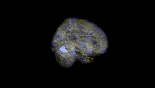 Full Brain Black