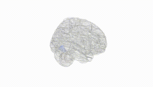 Full Brain White