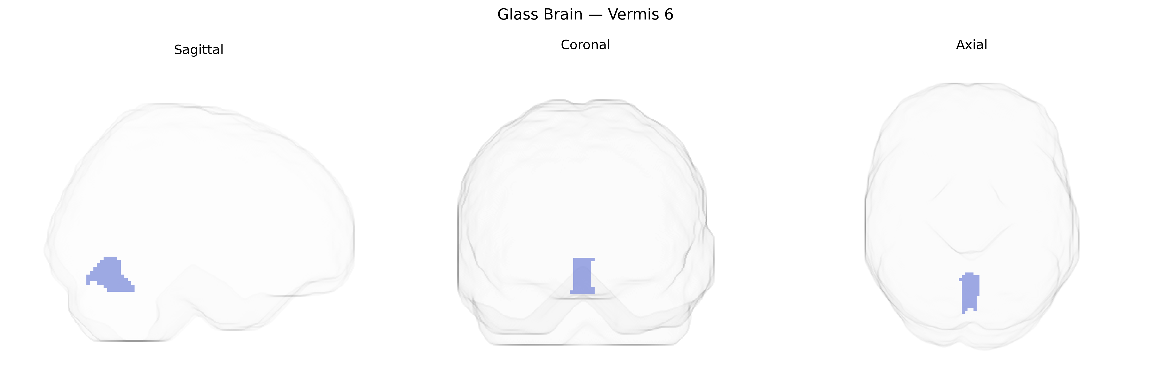 Triplanar Ghost Brain