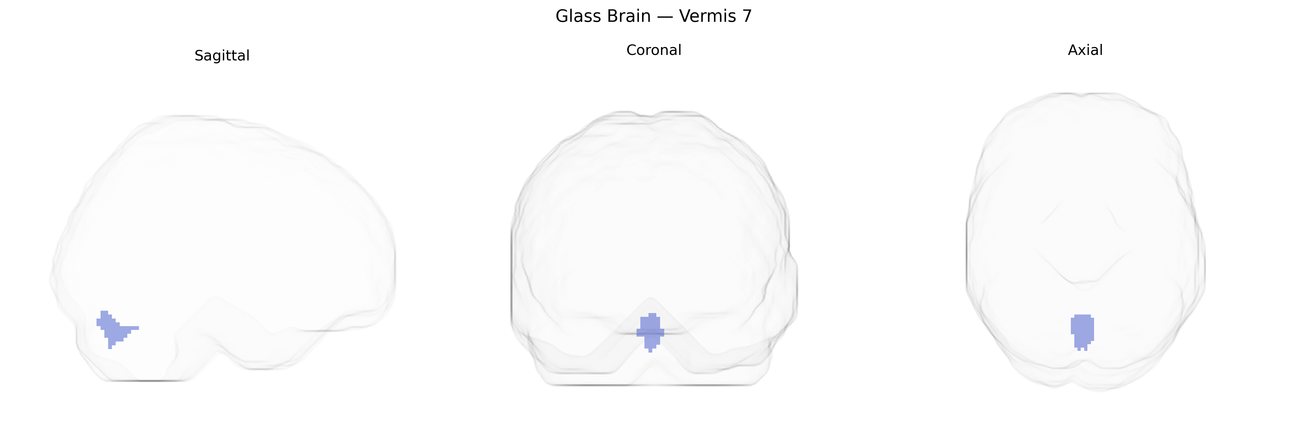 Triplanar Ghost Brain