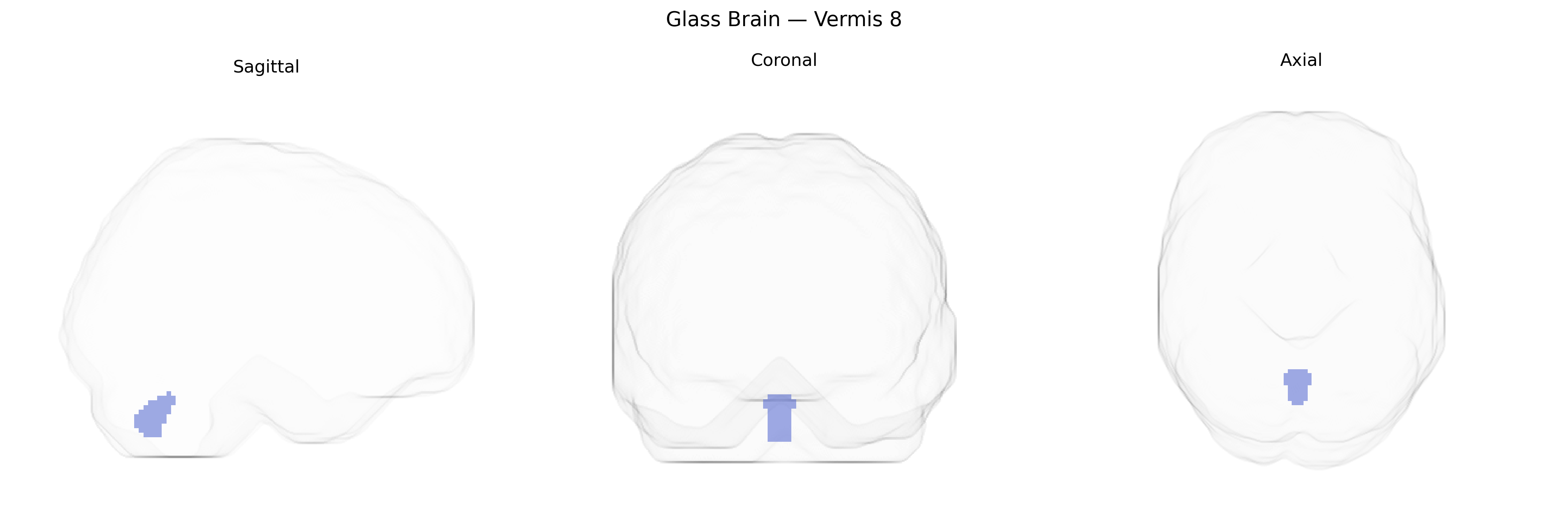 Triplanar Ghost Brain