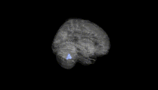 Full Brain Black