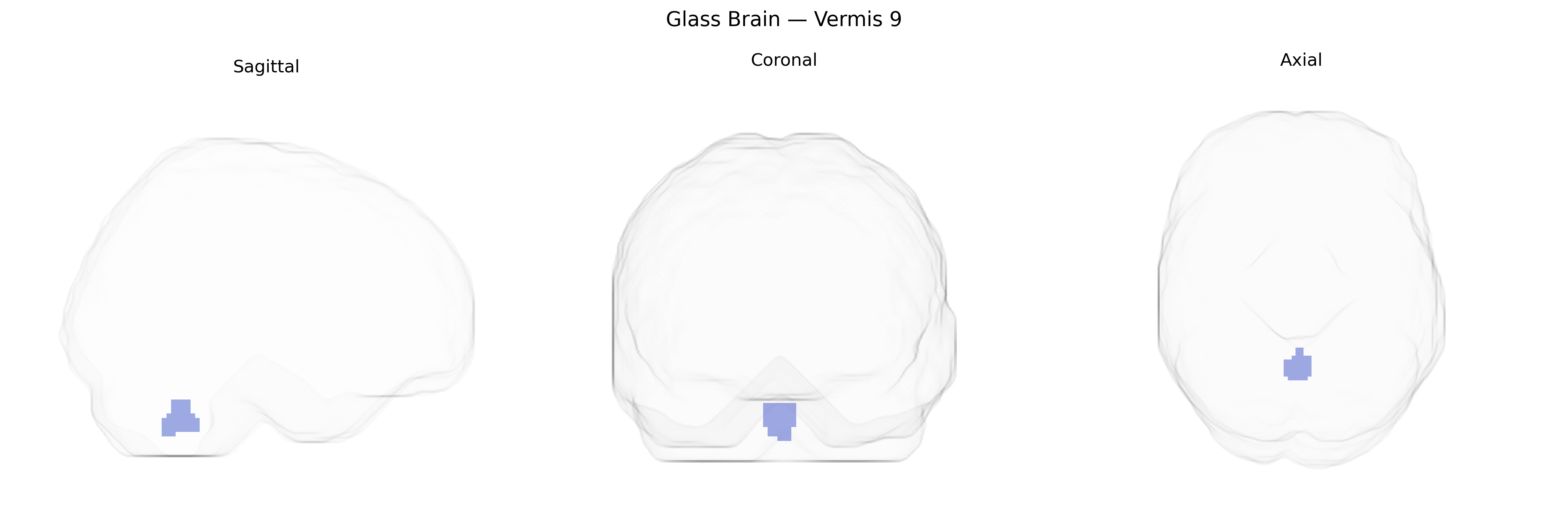Triplanar Ghost Brain