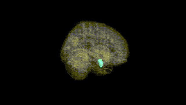 Full Brain Black