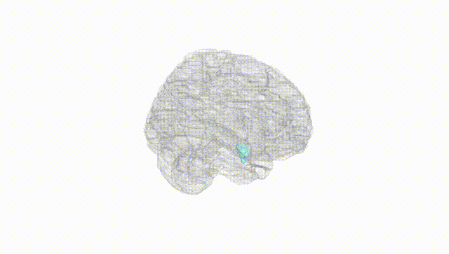 Full Brain White