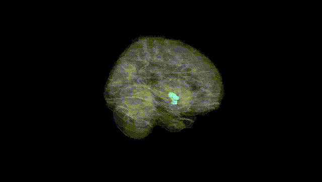 Full Brain Black