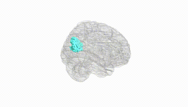 Full Brain White