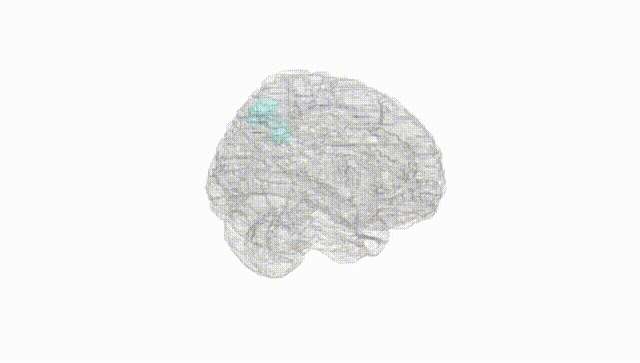Full Brain White