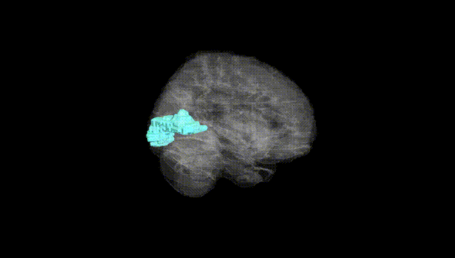 Full Brain Black