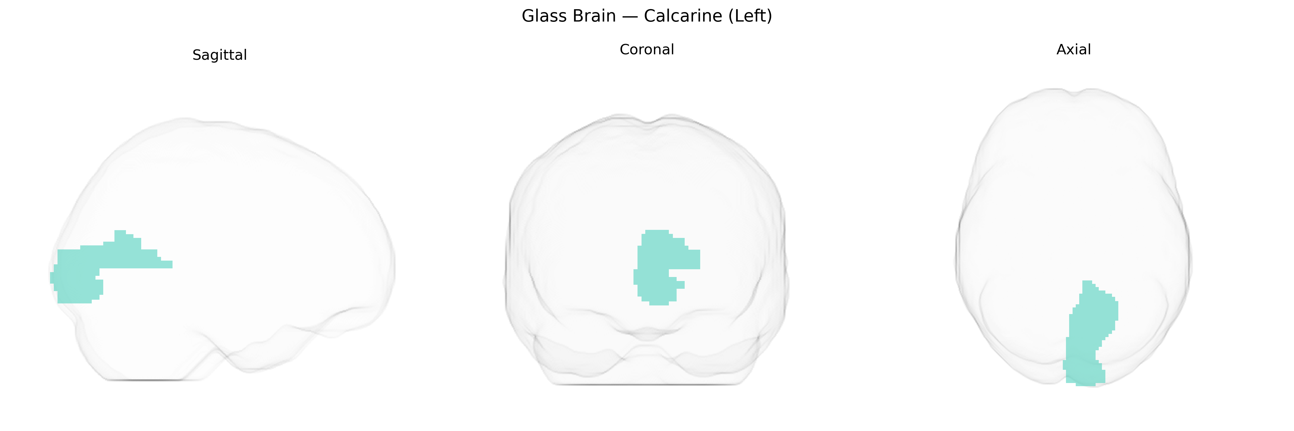 Triplanar Ghost Brain
