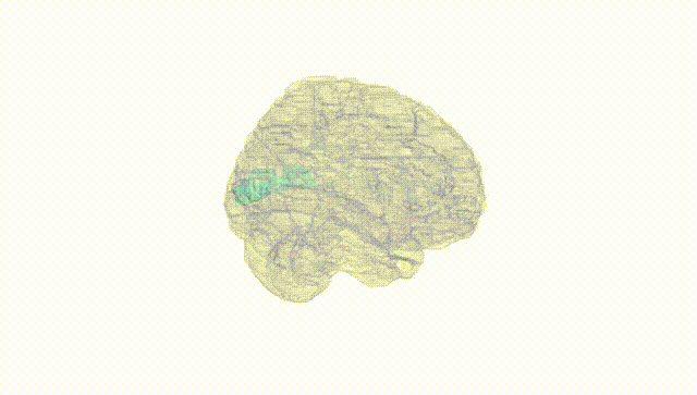 Full Brain White