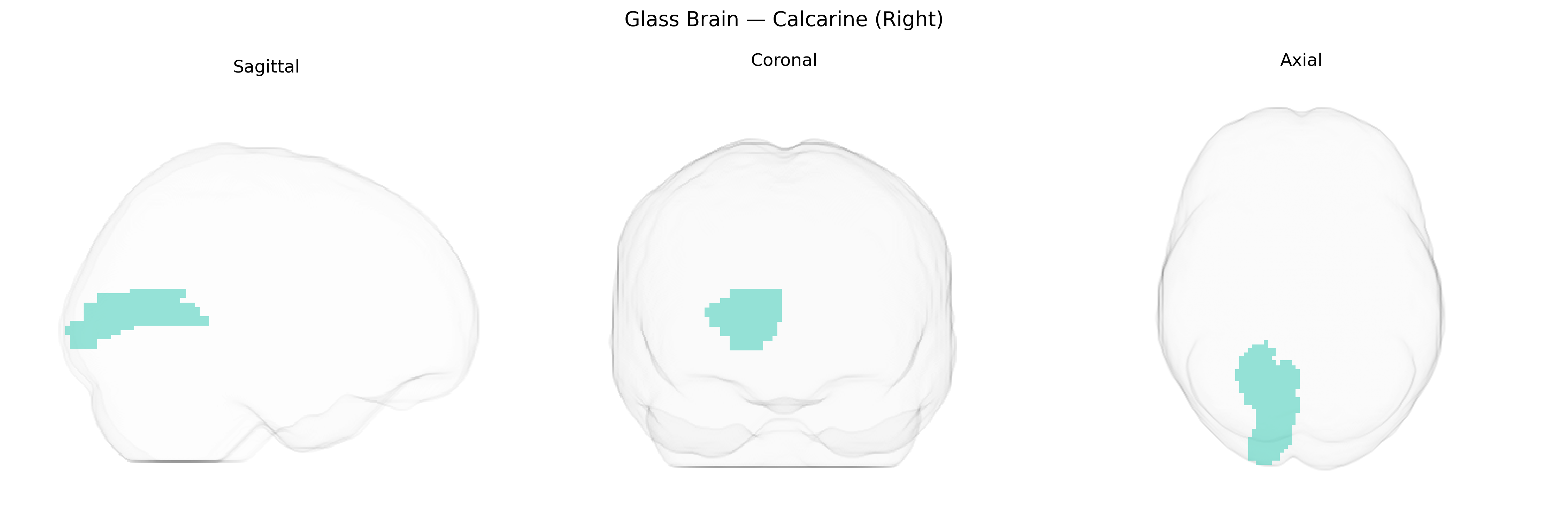 Triplanar Ghost Brain