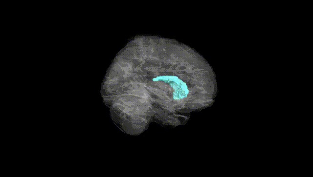 Full Brain Black