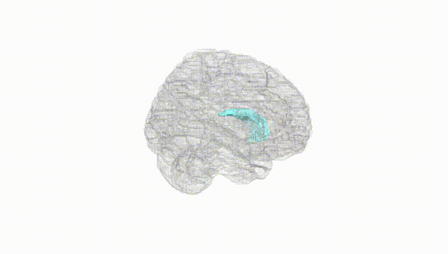 Full Brain White