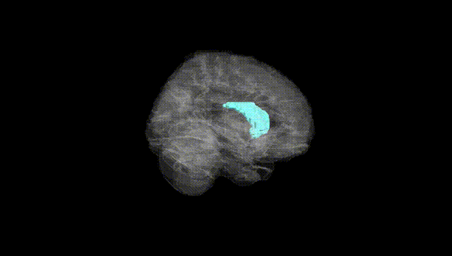 Full Brain Black