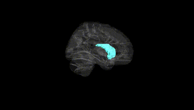 Hemisphere Black