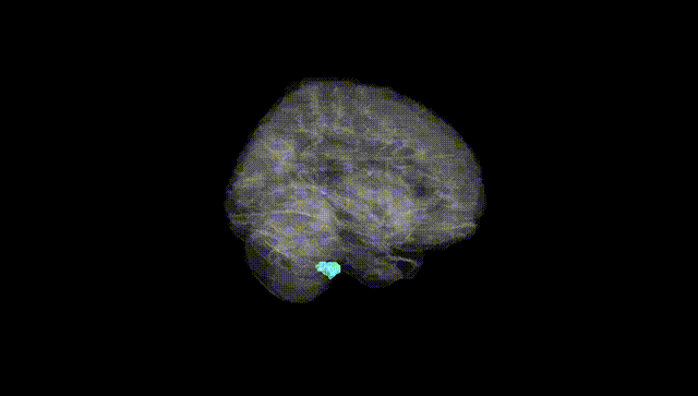 Full Brain Black