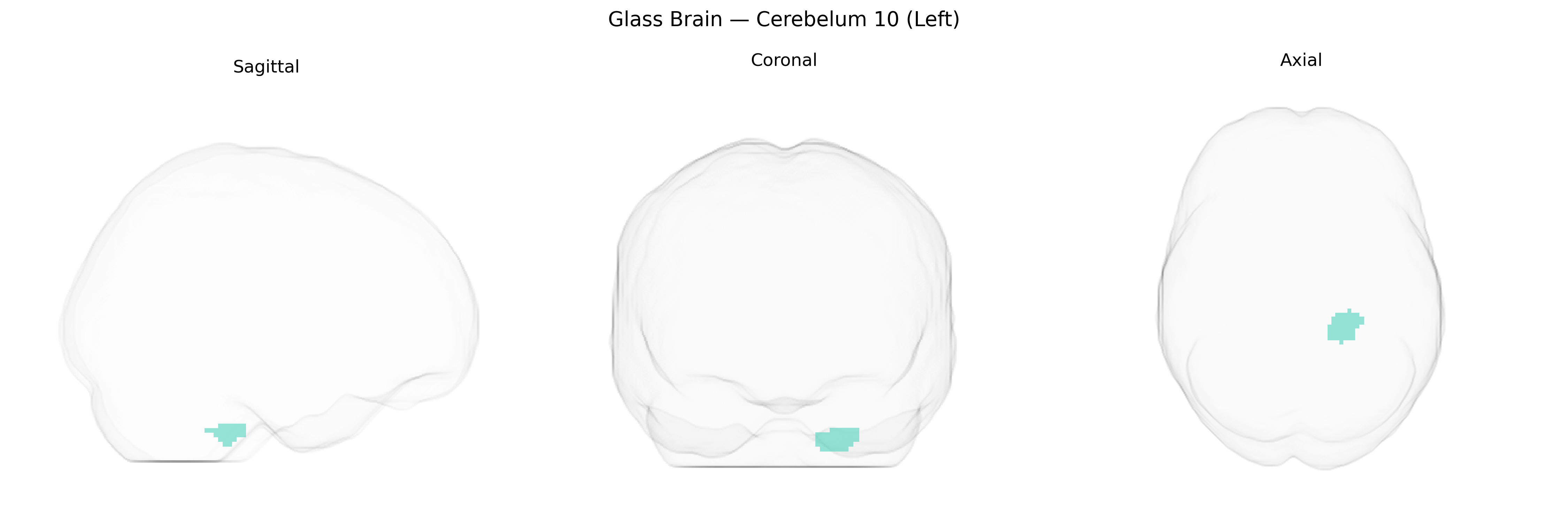 Triplanar Ghost Brain