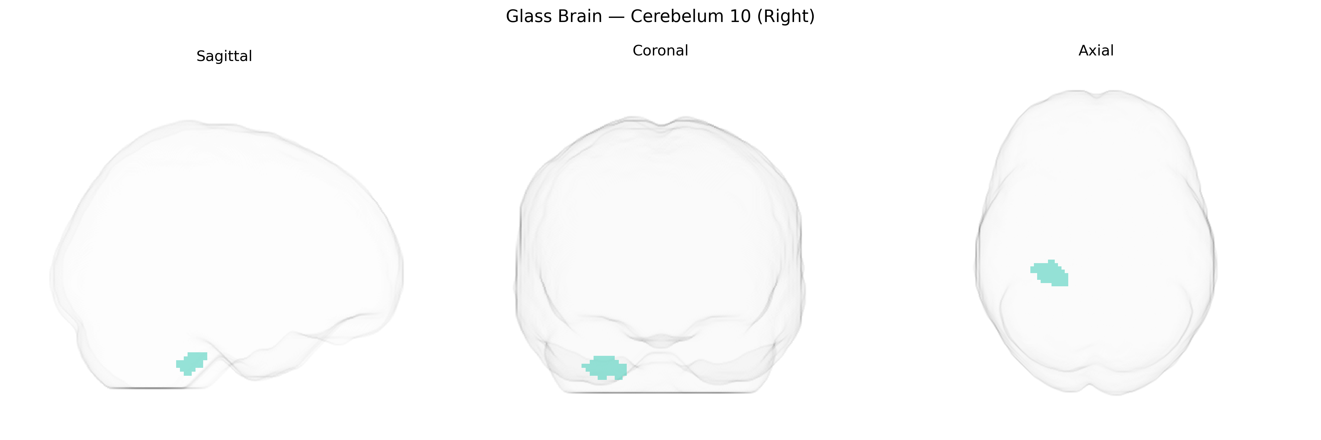 Triplanar Ghost Brain
