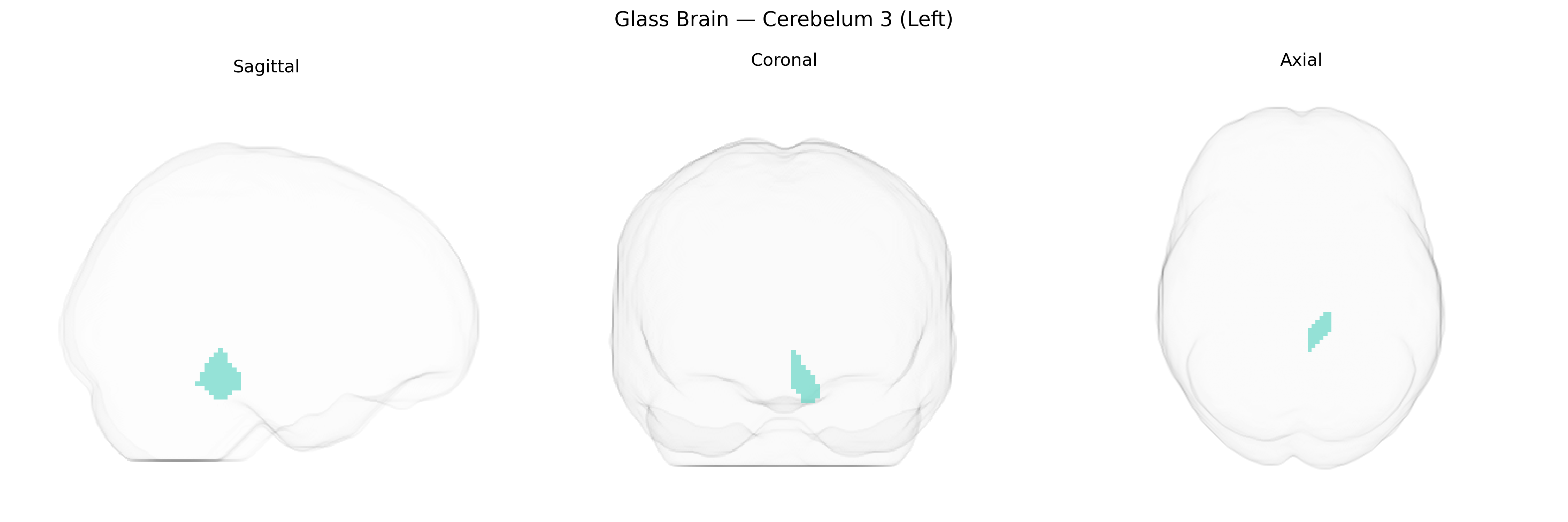 Triplanar Ghost Brain