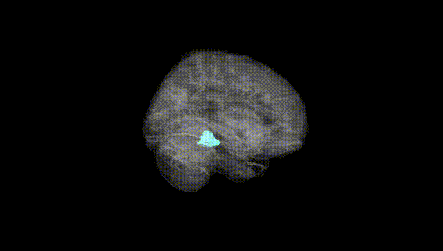 Full Brain Black