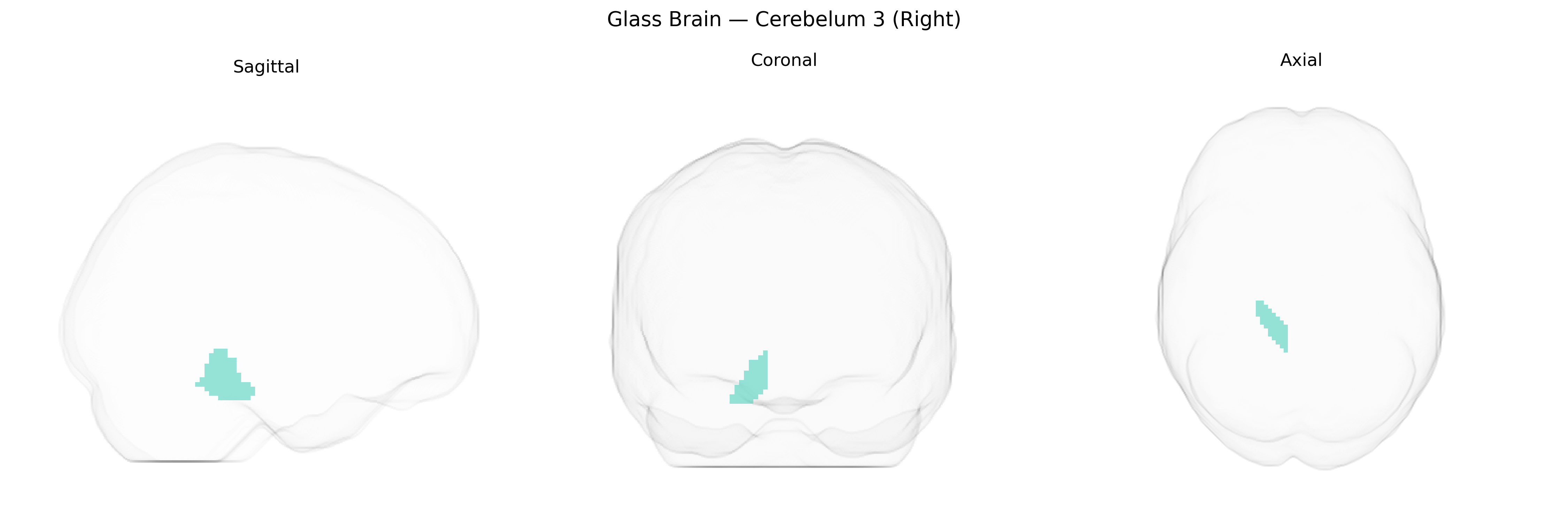 Triplanar Ghost Brain