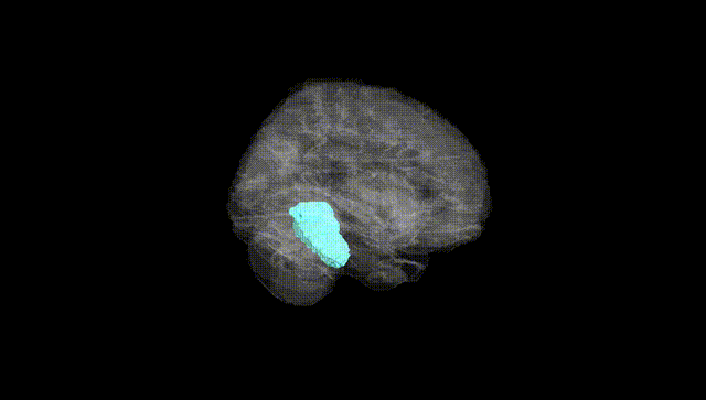 Full Brain Black