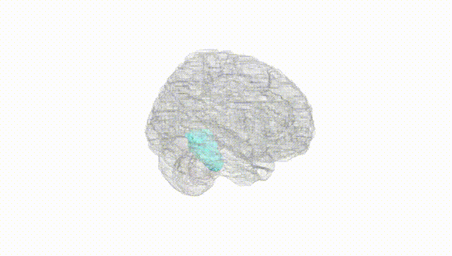 Full Brain White
