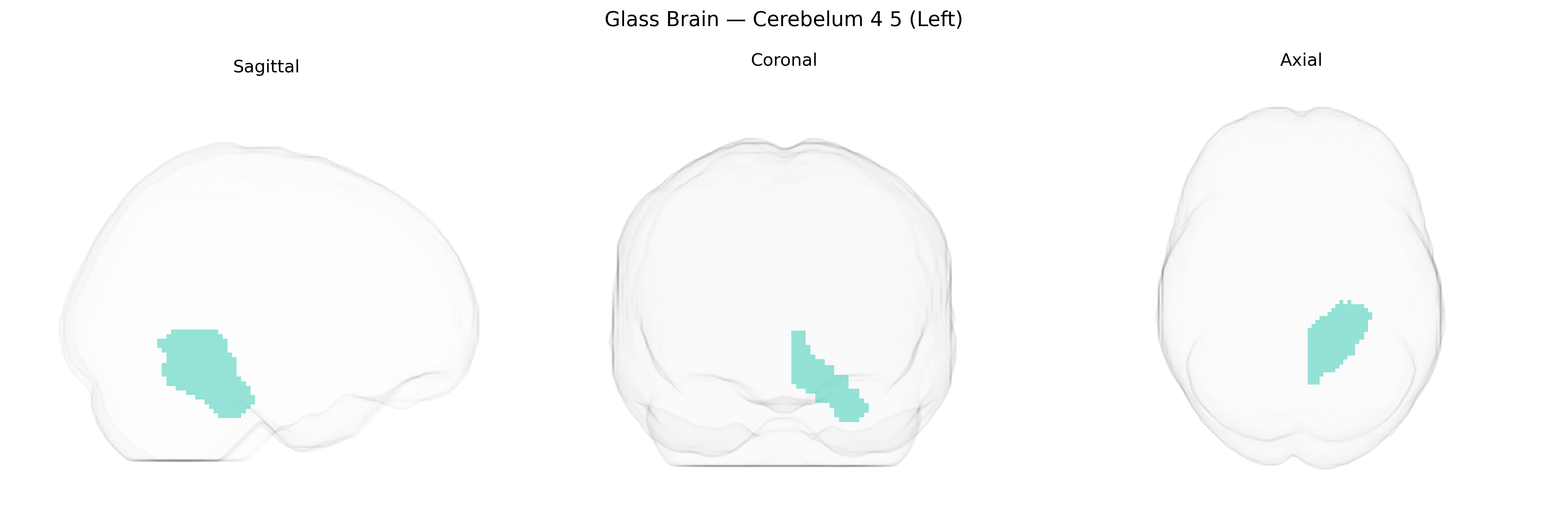 Triplanar Ghost Brain